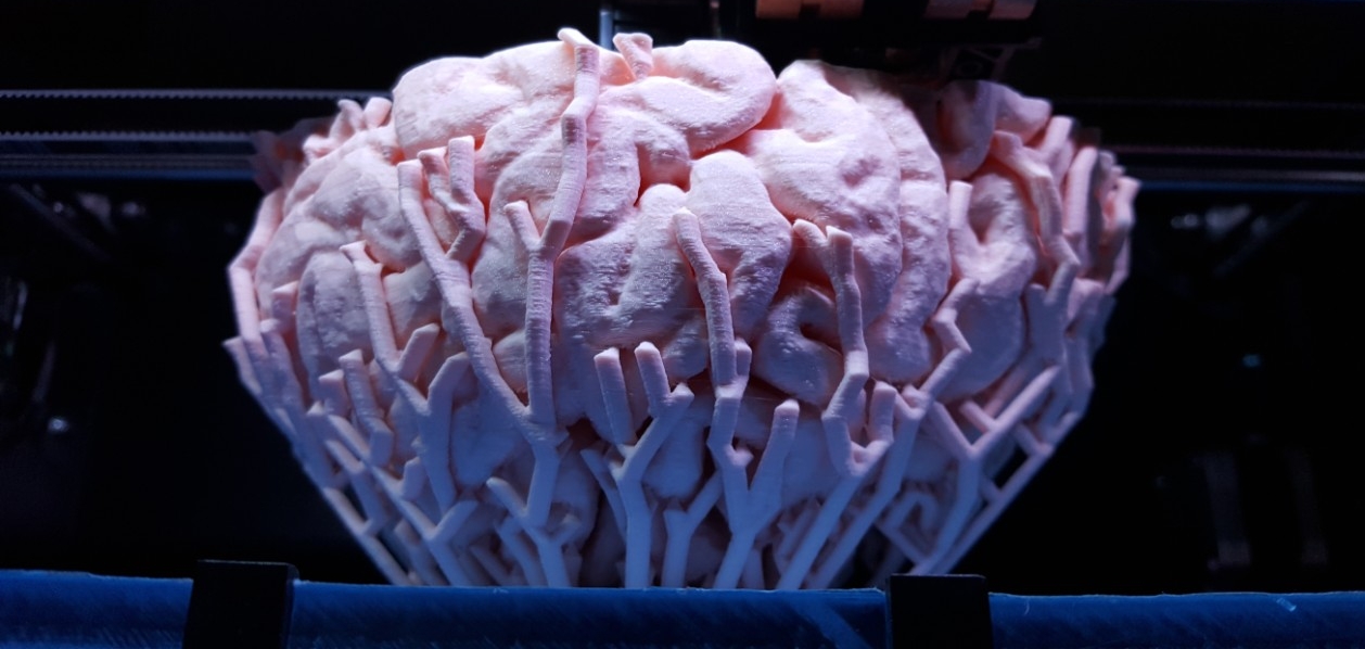 3D print of a brain